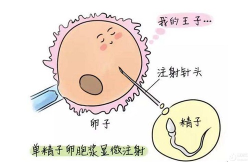 泰国试管技术为什么比国内好？因为条件少？