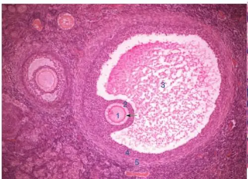 精子质量低做泰国试管婴儿成功率高吗？