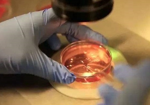 第三代辅助生殖技术好不好？